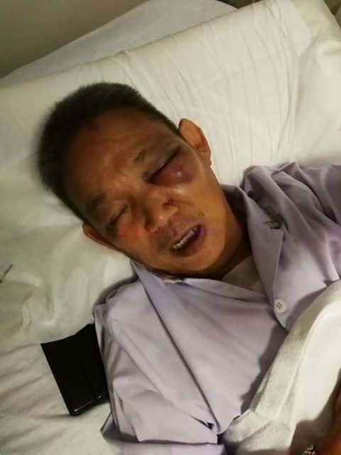 Elderly man assaulted in Hougang