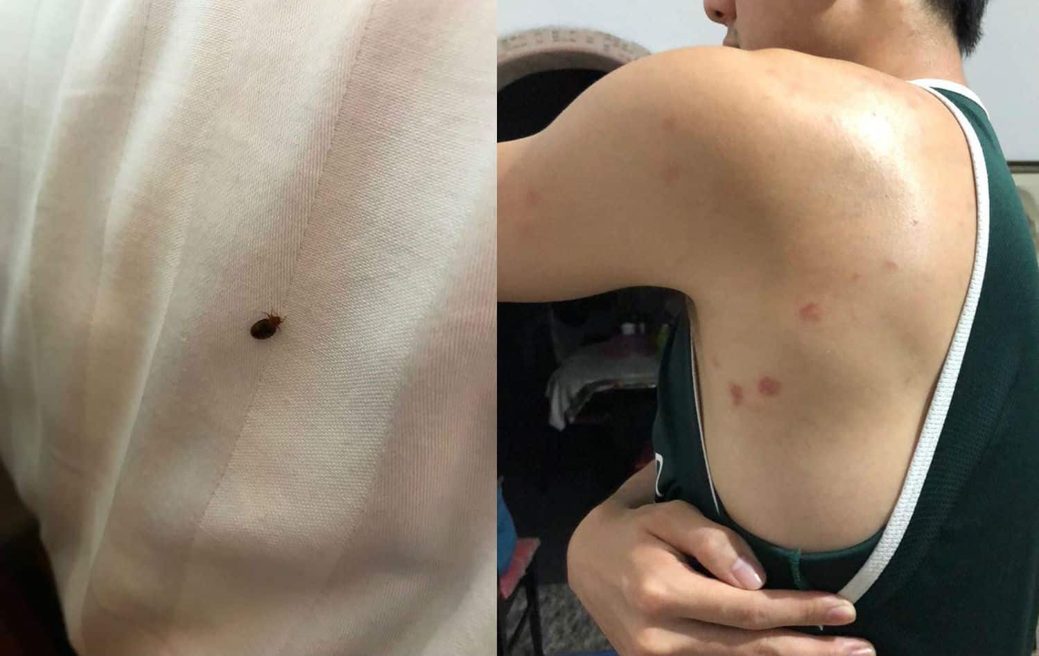 Cruise experience turned bad: Bedbugs found in two rooms on Costa Cruise