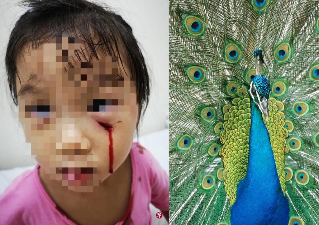 toddler attacked by peacock