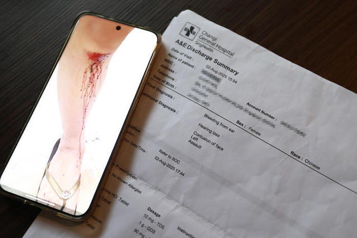 Bleeding wound on leg with hospital discharge summary, first aid and medical care.