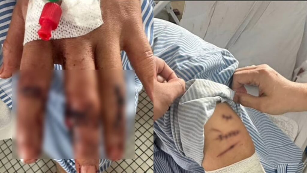 Singaporean man accused of attacking driver in Johor, victim’s left eye pierced by broken bottle and thumb tendon torn