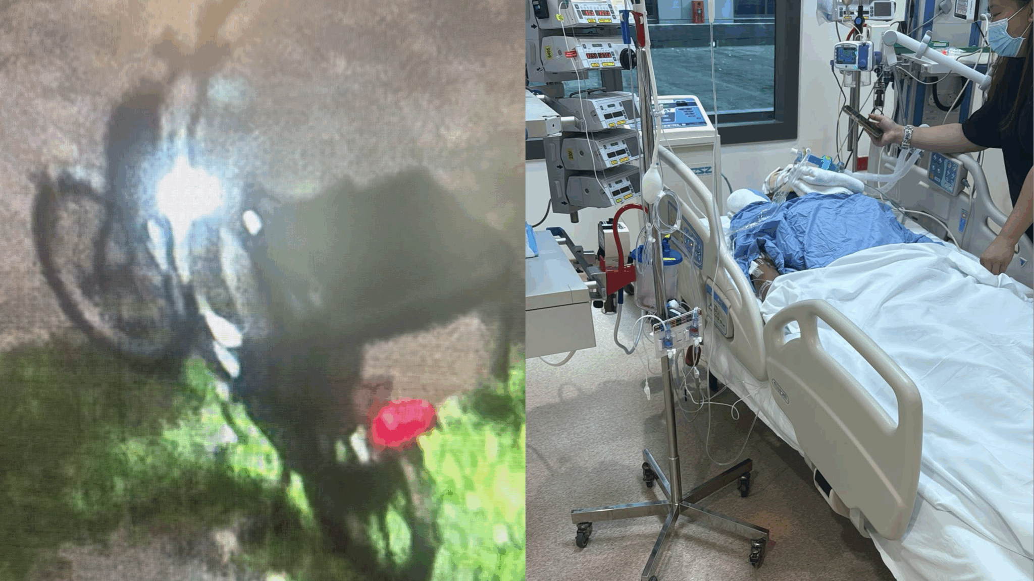 Man found unconscious with severe head injury after suspected accident in Punggol; family appealing for witnesses